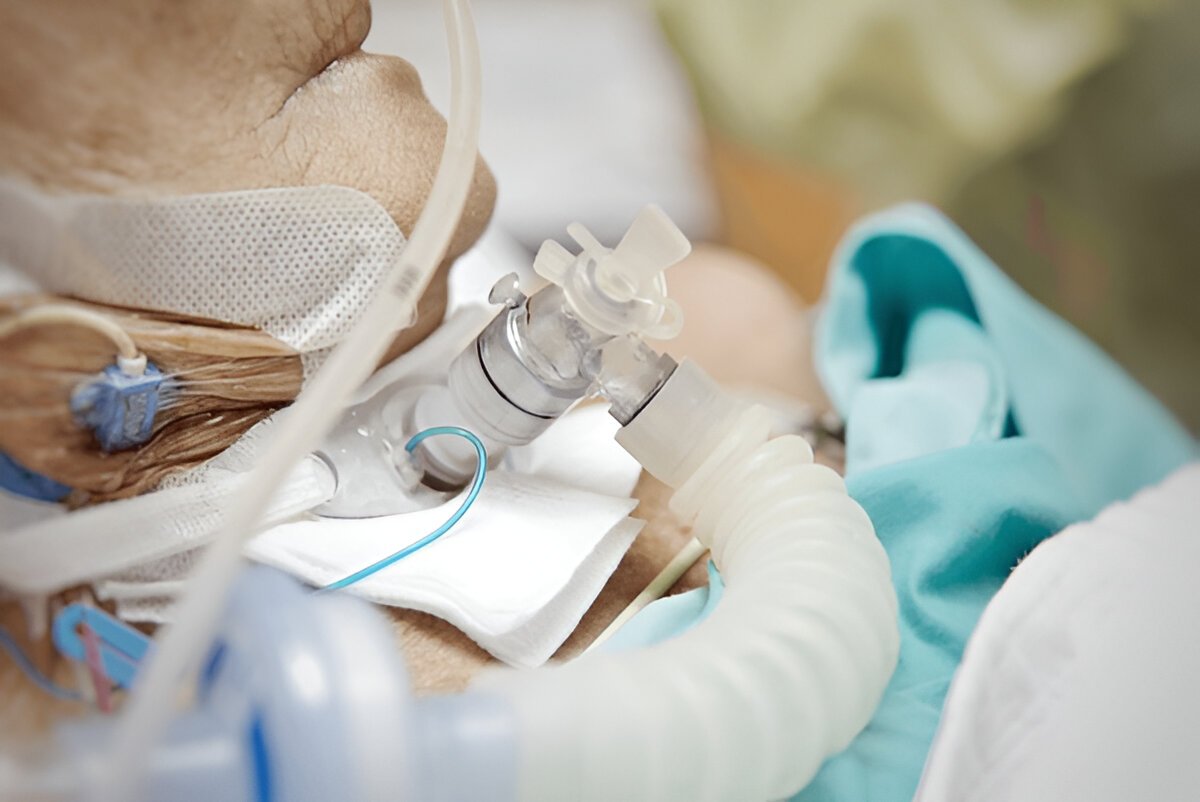 Tracheostomy Care At Home